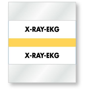 Color-Coded Chart Divider Tabs, 1-1/2" x 1-1/4"