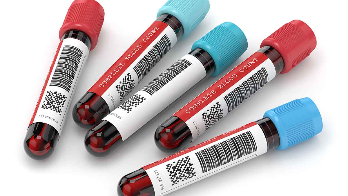 Printing Blood Vial Labels With a Desktop Printer